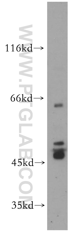 WB analysis of HL-60 using 14515-1-AP