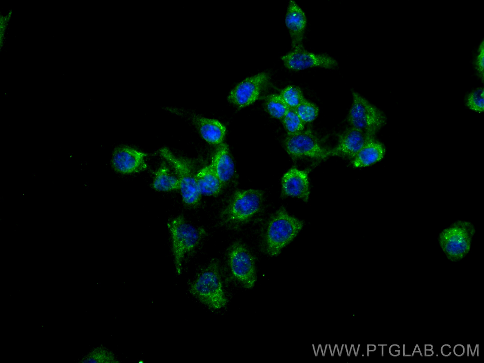 IF Staining of U2OS using 67931-1-Ig (same clone as 67931-1-PBS)