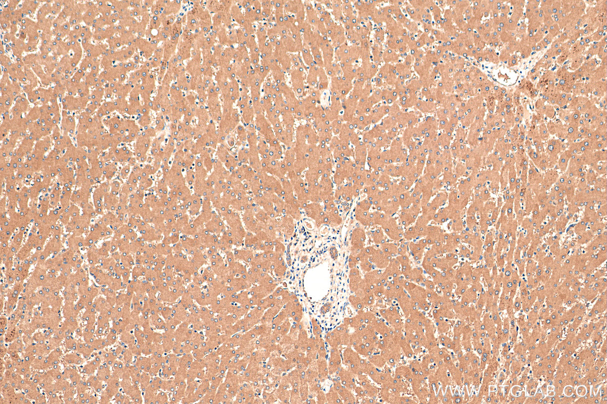 IHC staining of human liver using 27941-1-AP