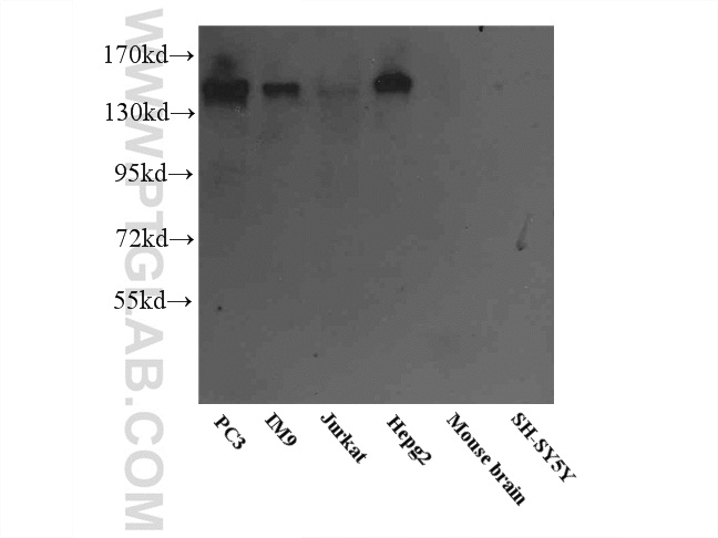 WB analysis of multi-cells/tissue using 55123-1-AP