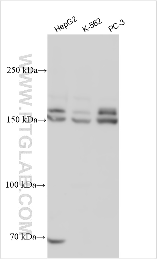 WB analysis using 55123-1-AP