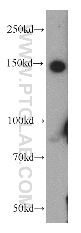 WB analysis of K-562 using 55123-1-AP