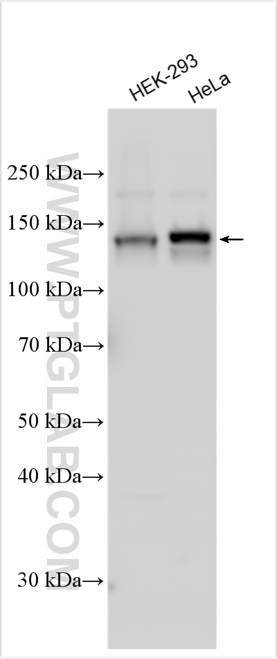 WB analysis using 29415-1-AP