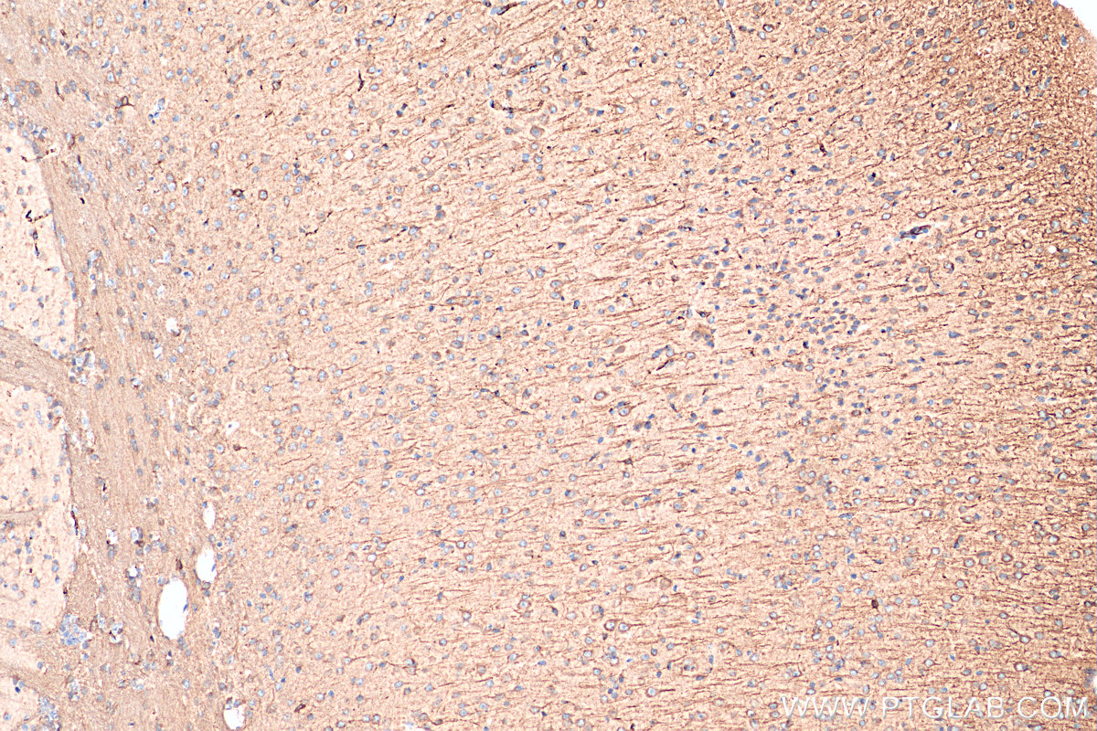 IHC staining of mouse brain using 25473-1-AP