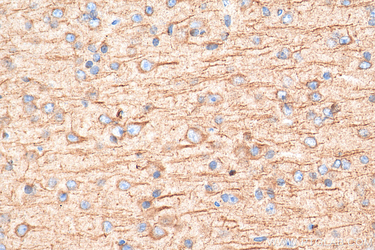 IHC staining of mouse brain using 25473-1-AP