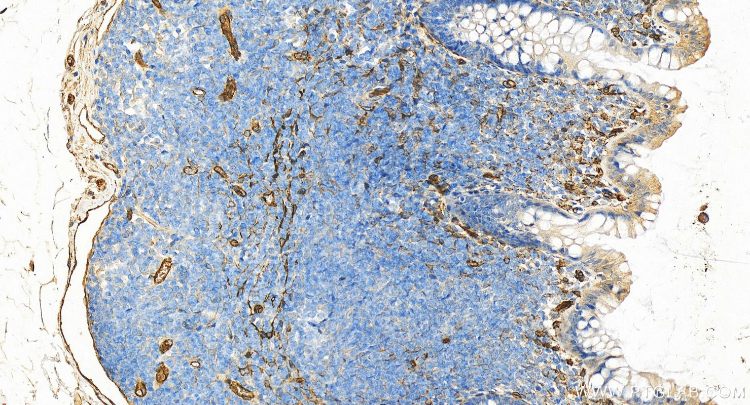 IHC staining of human normal colon using 18892-1-AP