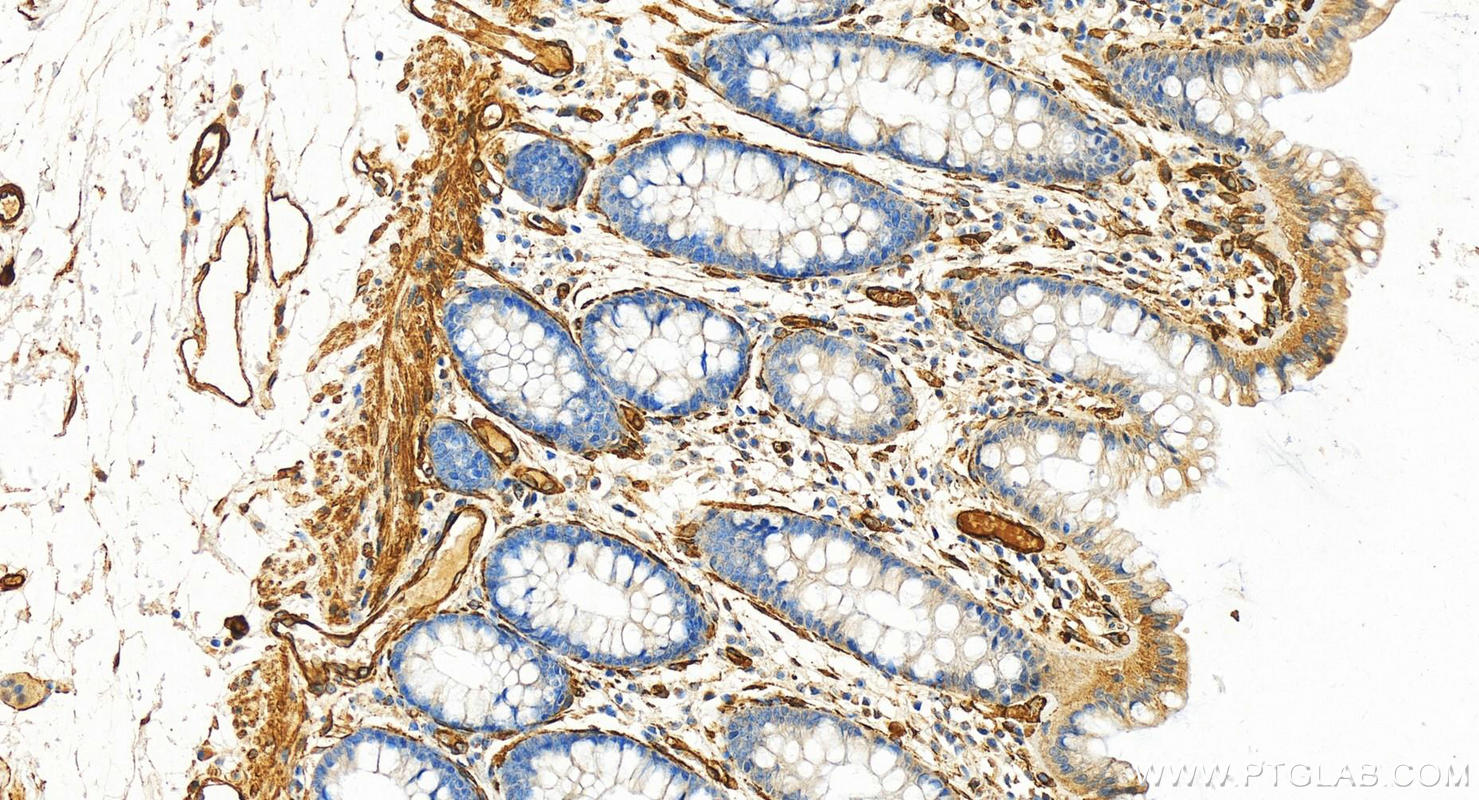 IHC staining of human normal colon using 18892-1-AP