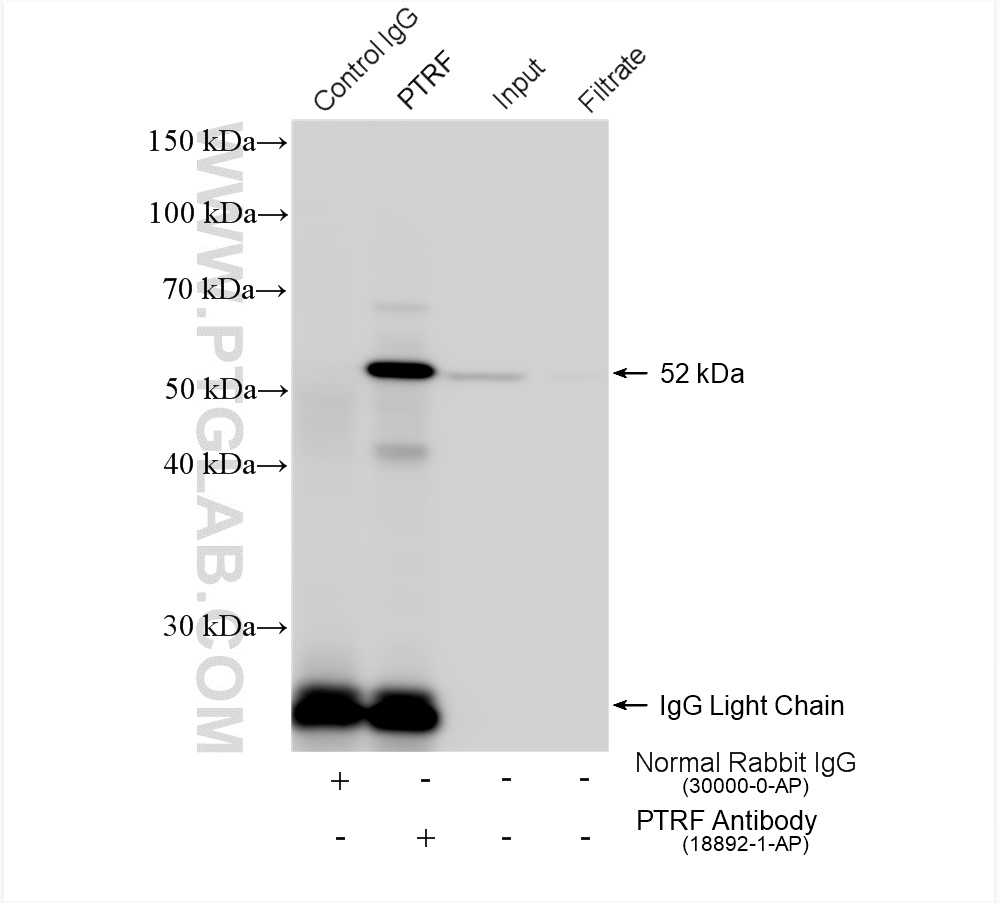 IP experiment of HT-1080 using 18892-1-AP