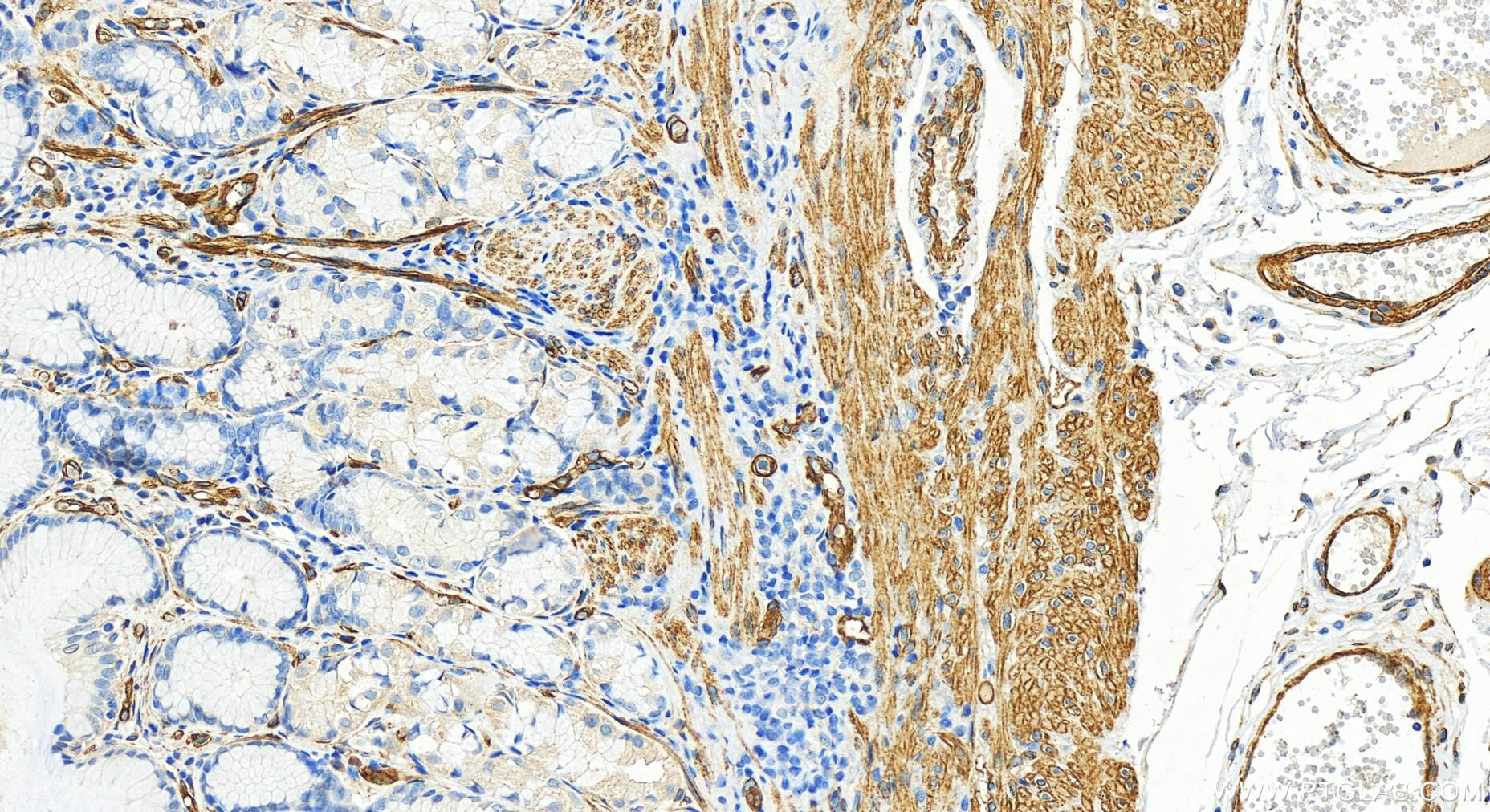 IHC staining of human stomach using 30086-1-AP