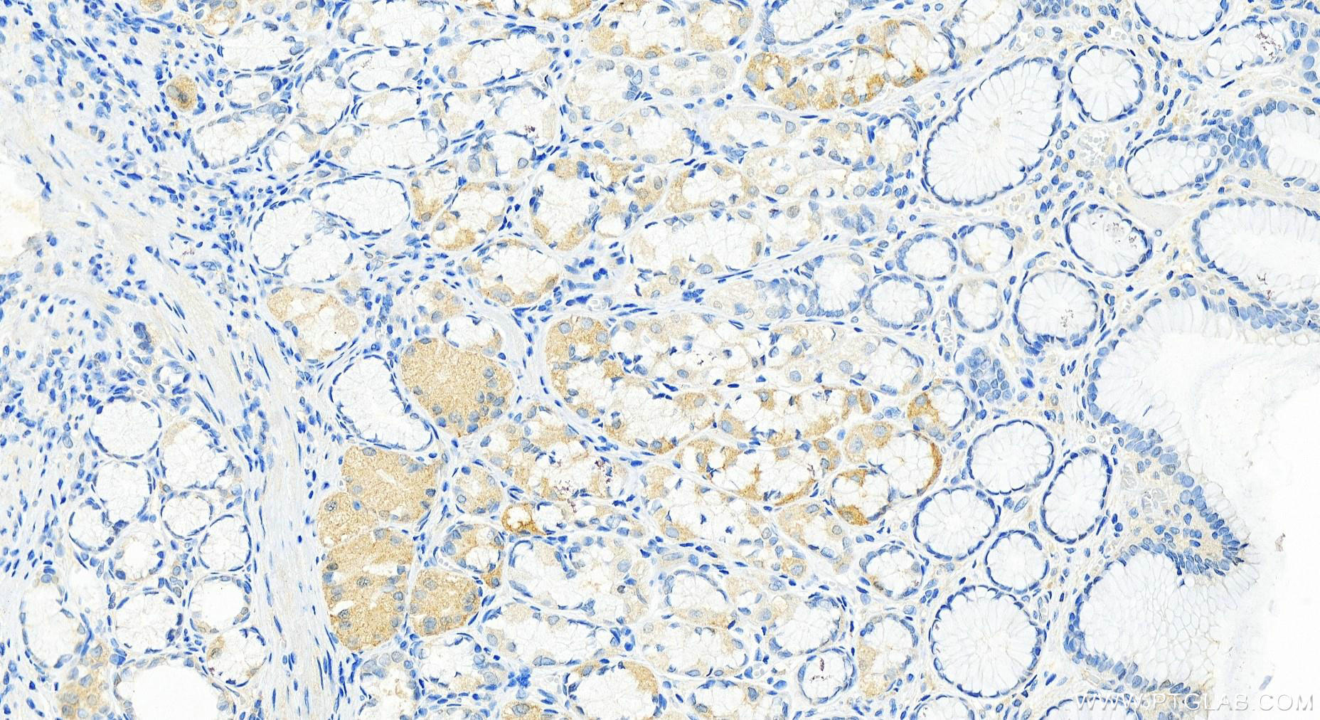 IHC staining of human stomach using 82697-1-RR (same clone as 82697-1-PBS)