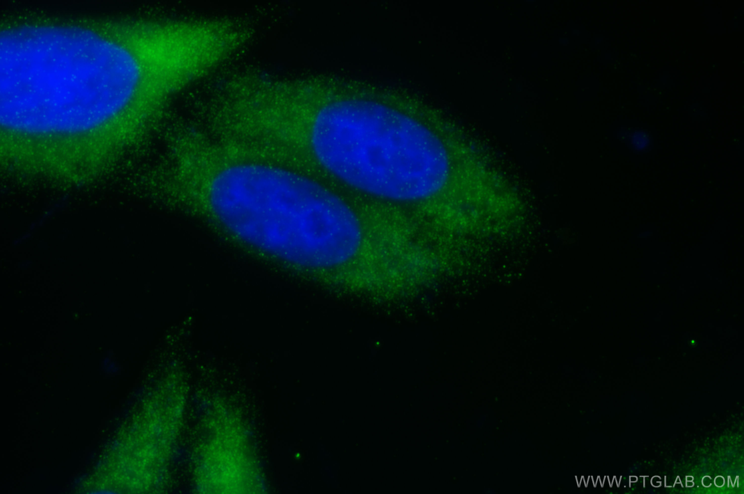 IF Staining of HepG2 using 82697-1-RR (same clone as 82697-1-PBS)