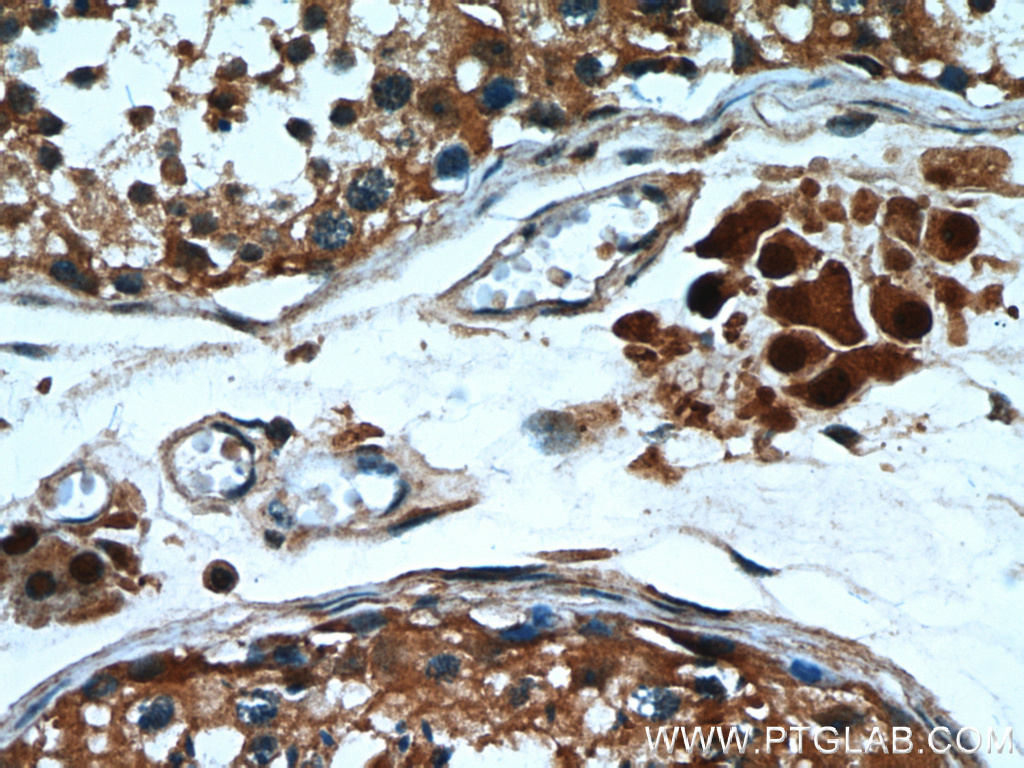 IHC staining of human testis using 12575-1-AP