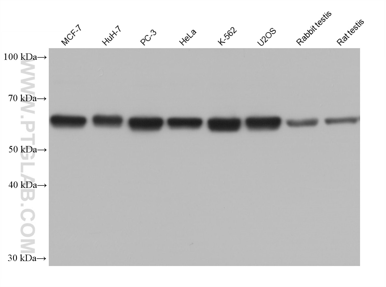 WB analysis using 68533-1-Ig (same clone as 68533-1-PBS)