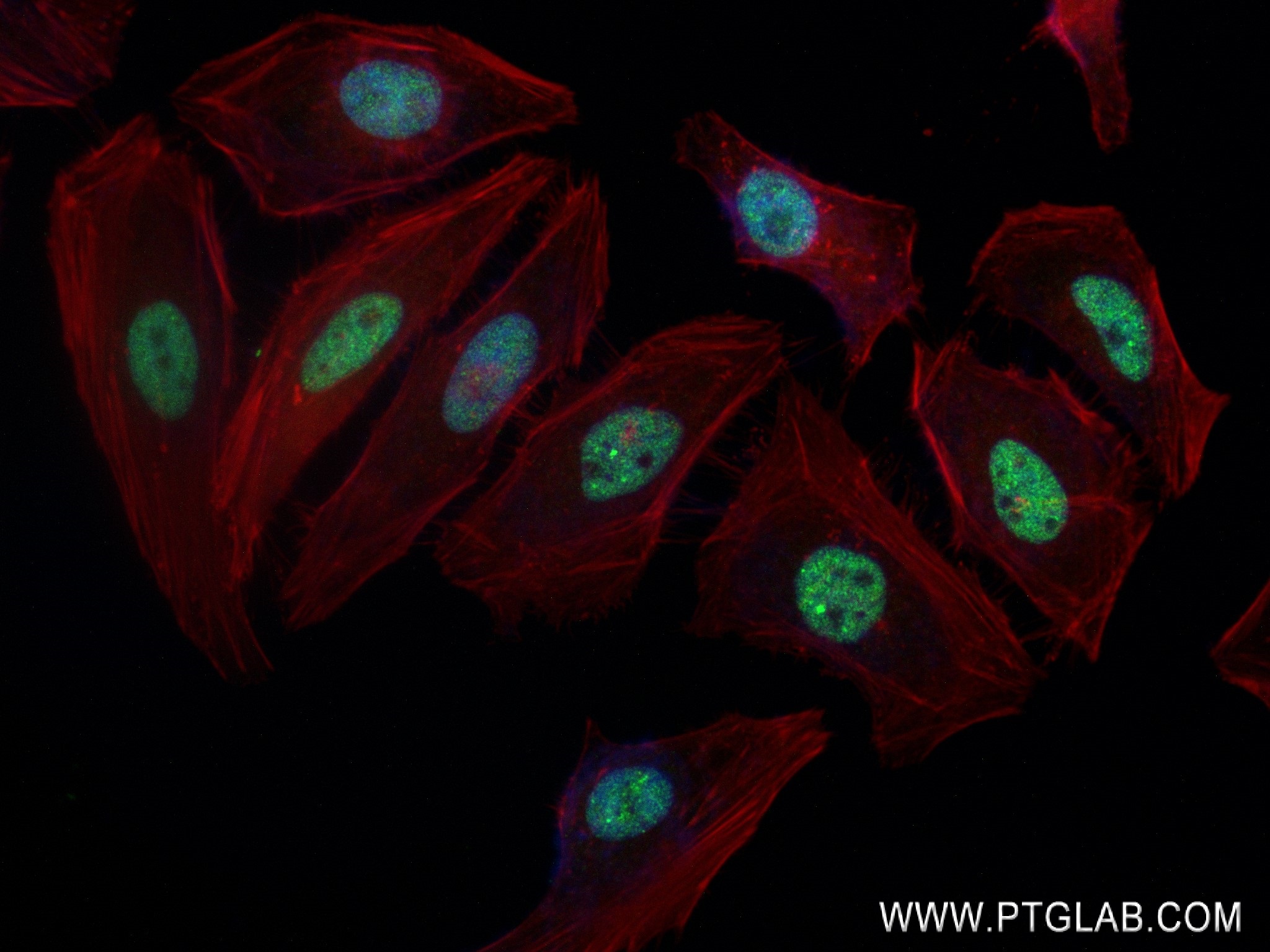 IF Staining of HeLa using 84399-3-RR (same clone as 84399-3-PBS)