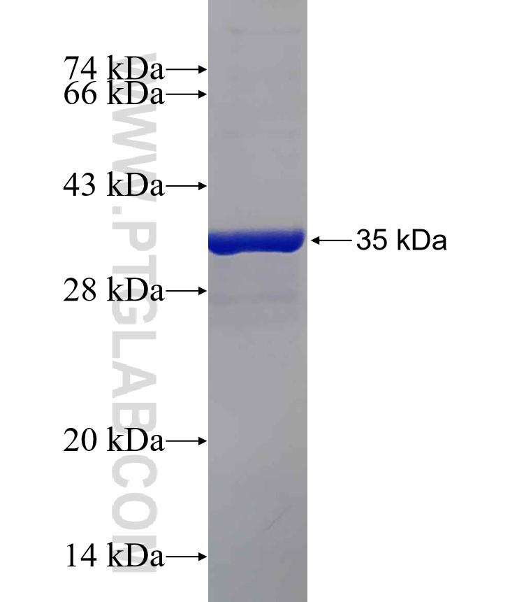 PVRIG fusion protein Ag30598 SDS-PAGE