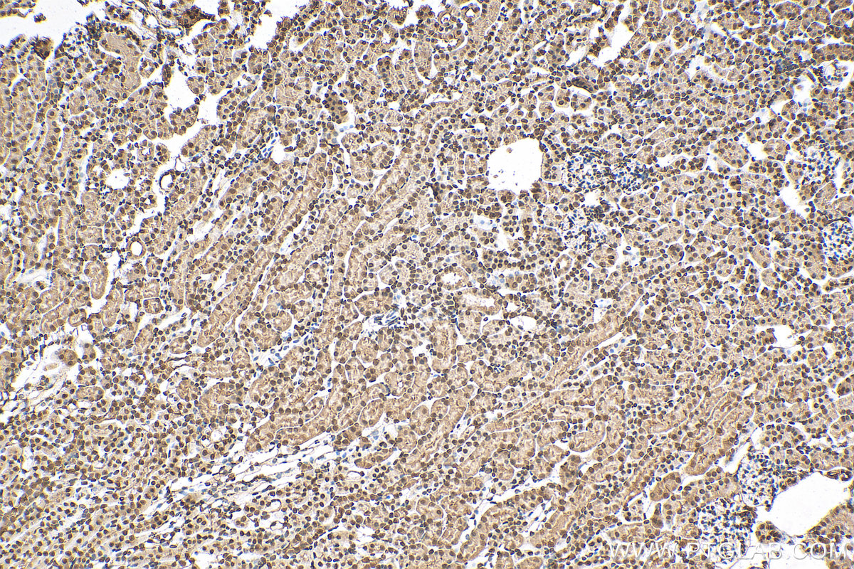 IHC staining of mouse kidney using 67912-1-Ig (same clone as 67912-1-PBS)