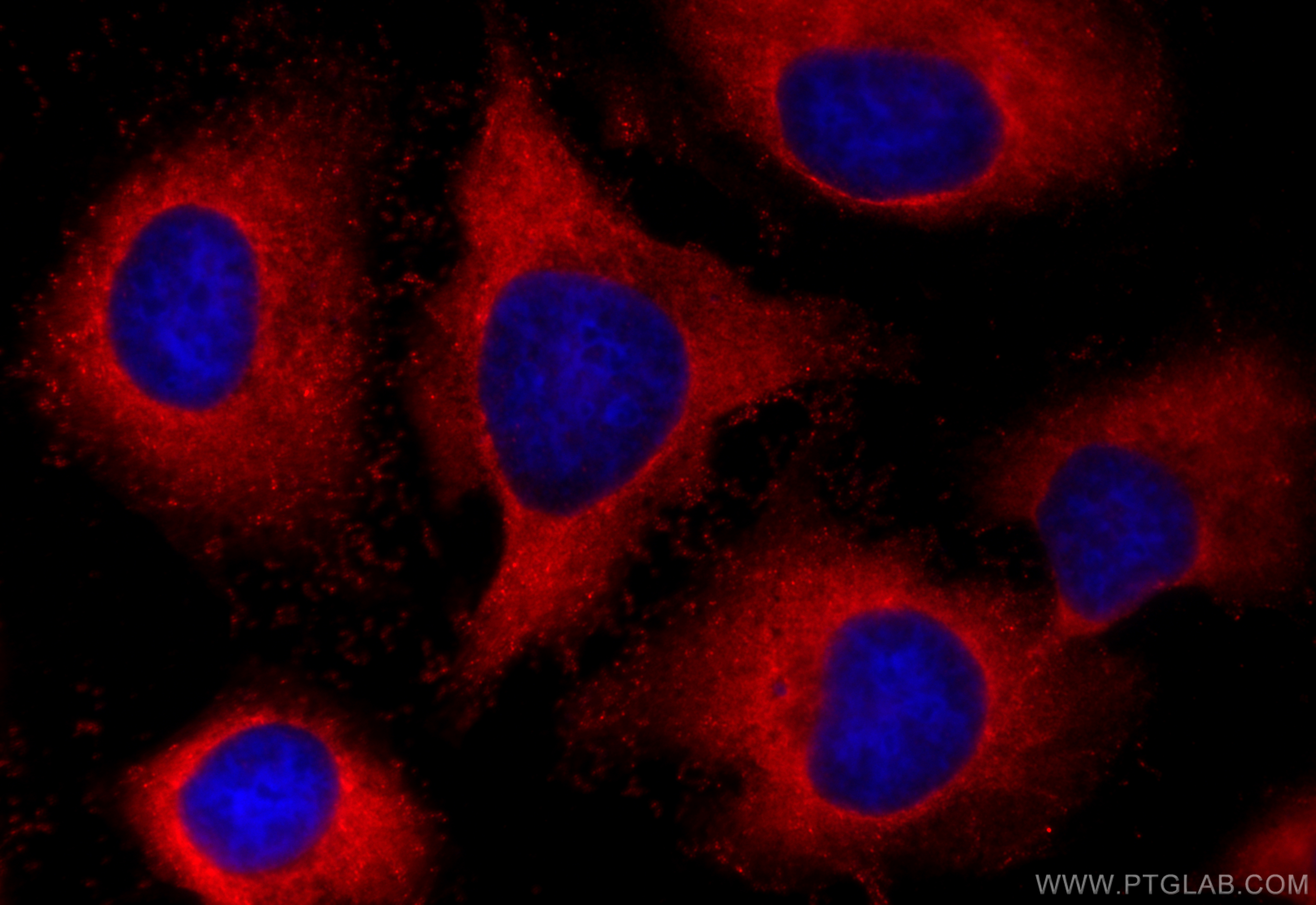 IF Staining of HeLa using 55060-1-AP