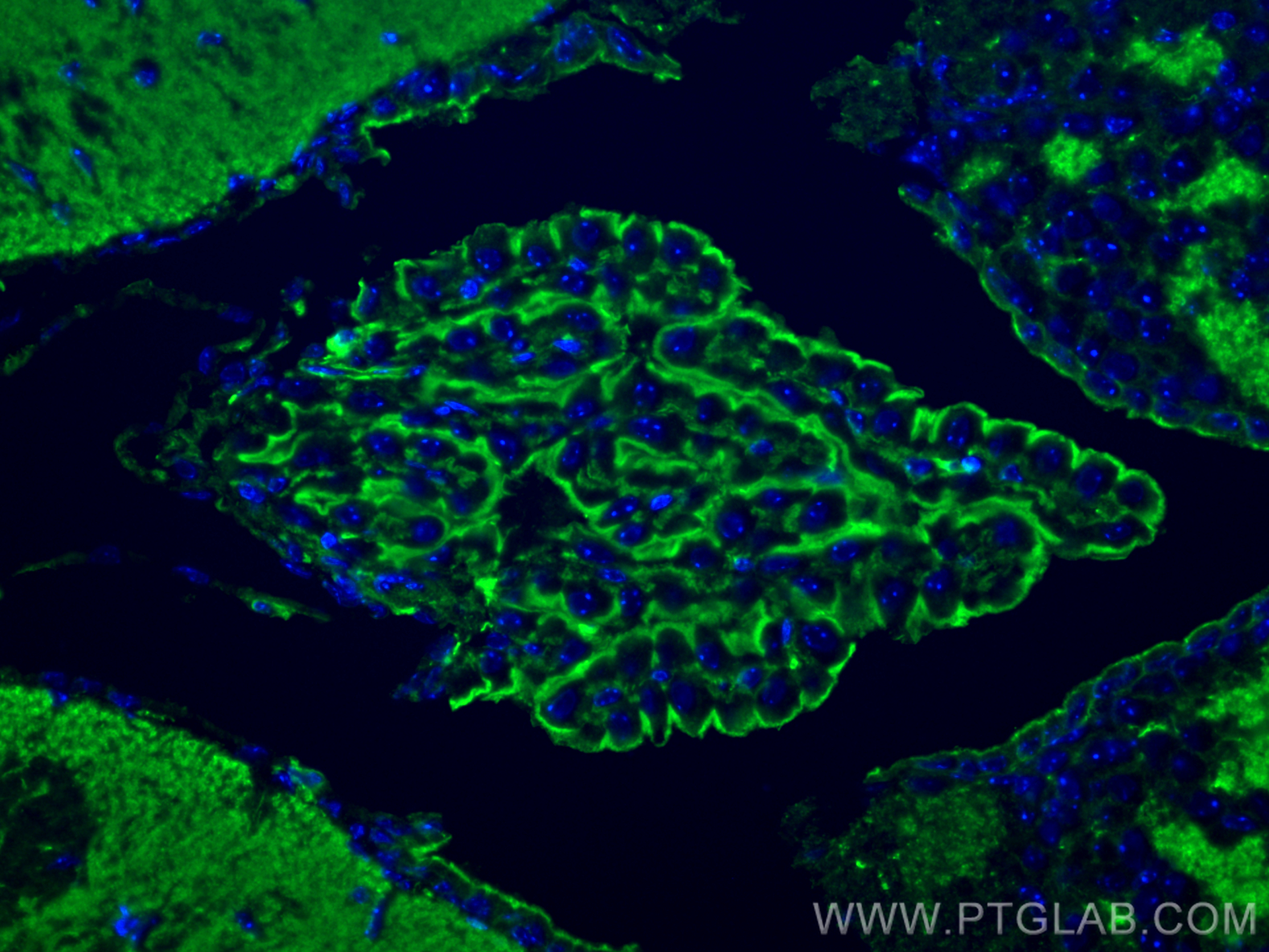 IF Staining of mouse brain using 66009-1-Ig