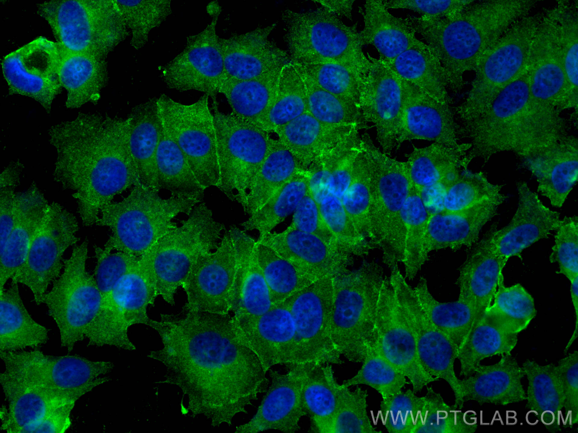 IF Staining of MCF-7 using 31313-1-AP