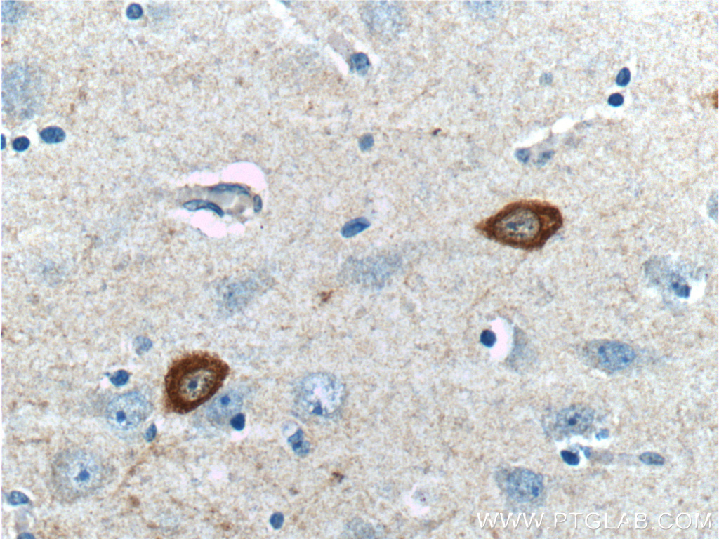 IHC staining of human brain using 26521-1-AP