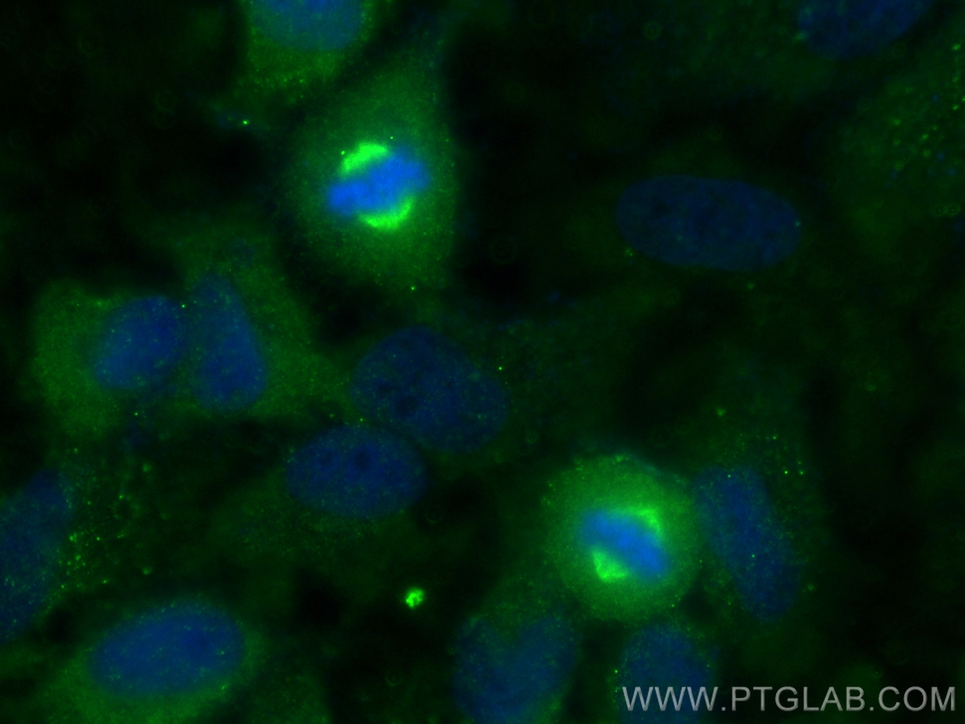 IF Staining of HeLa using 22271-1-AP