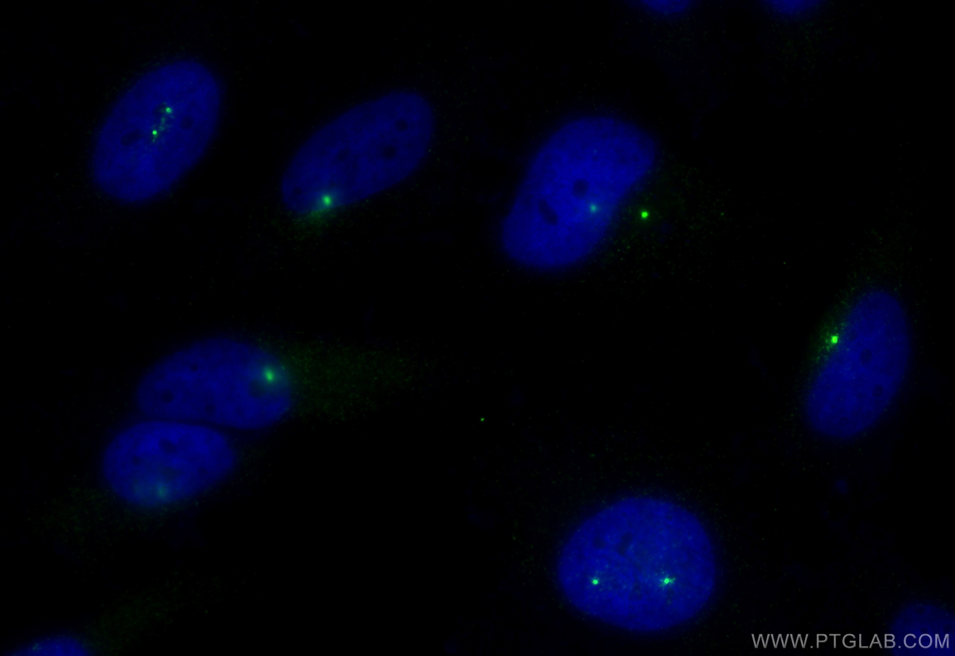 IF Staining of HeLa using 27084-1-AP