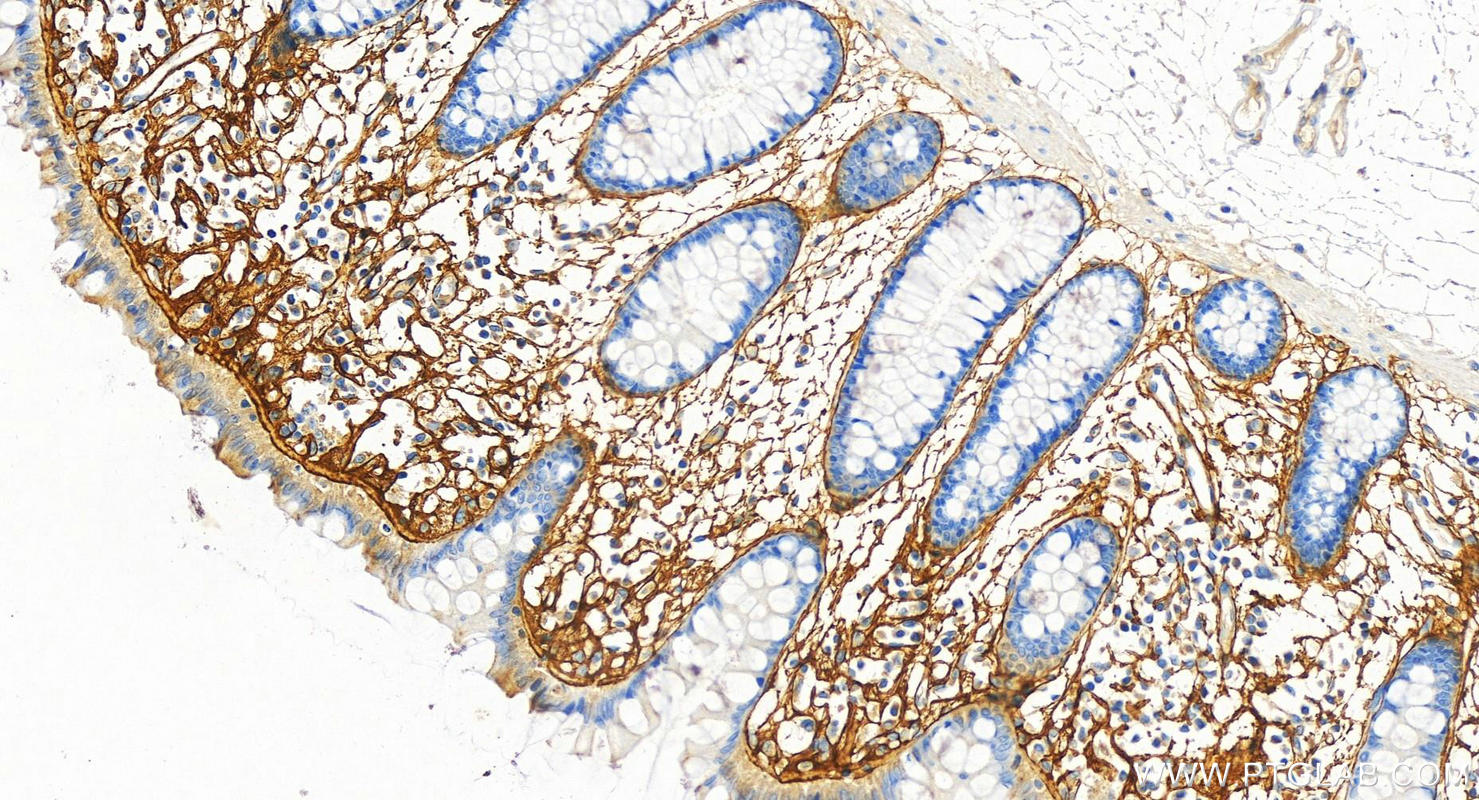 IHC staining of human colon using 66491-1-Ig