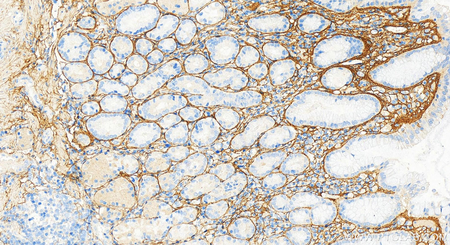 IHC staining of human stomach using 66491-1-Ig