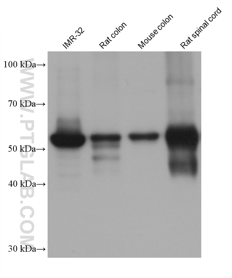 WB analysis using 66317-1-Ig