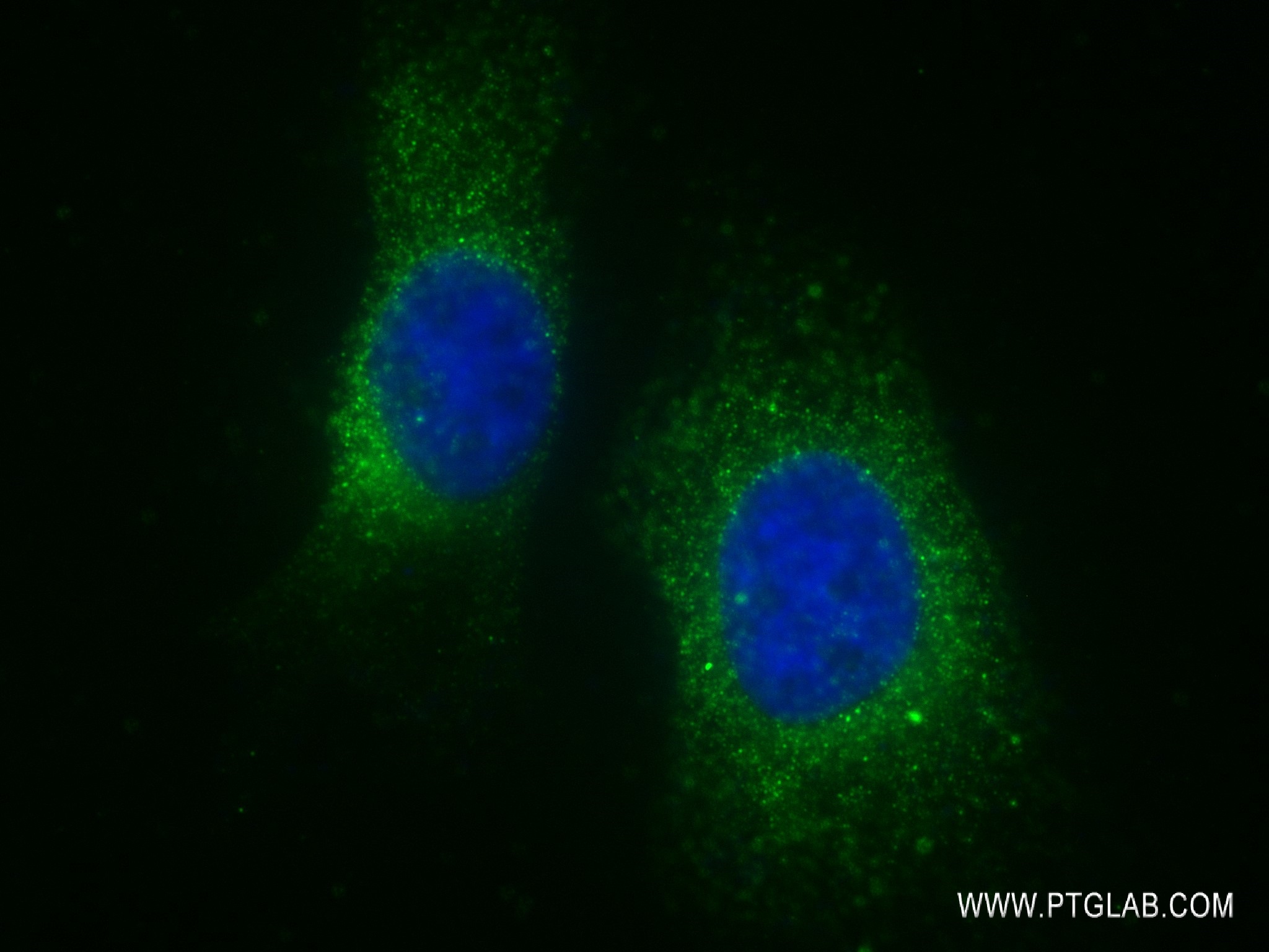 IF Staining of HeLa using 80281-2-RR (same clone as 80281-2-PBS)