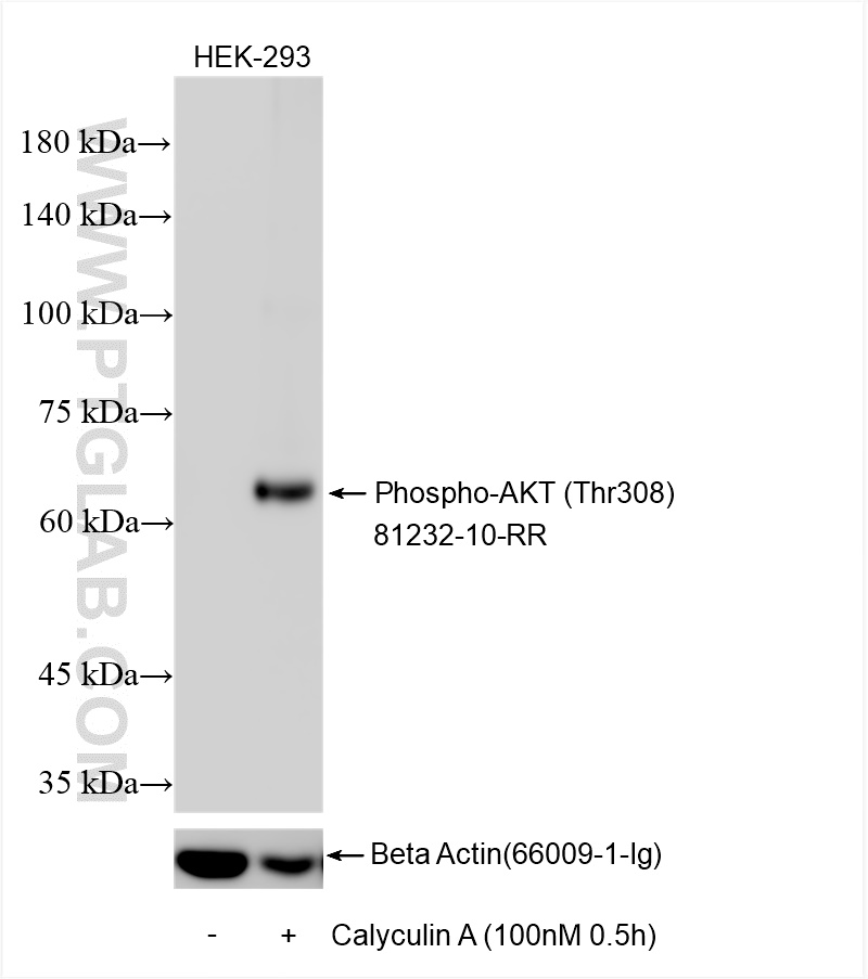 WB analysis using 81232-10-RR