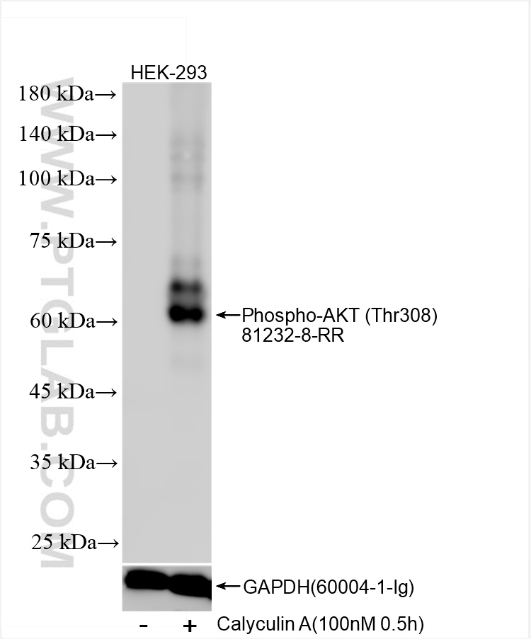 Phospho-AKT (Thr308)