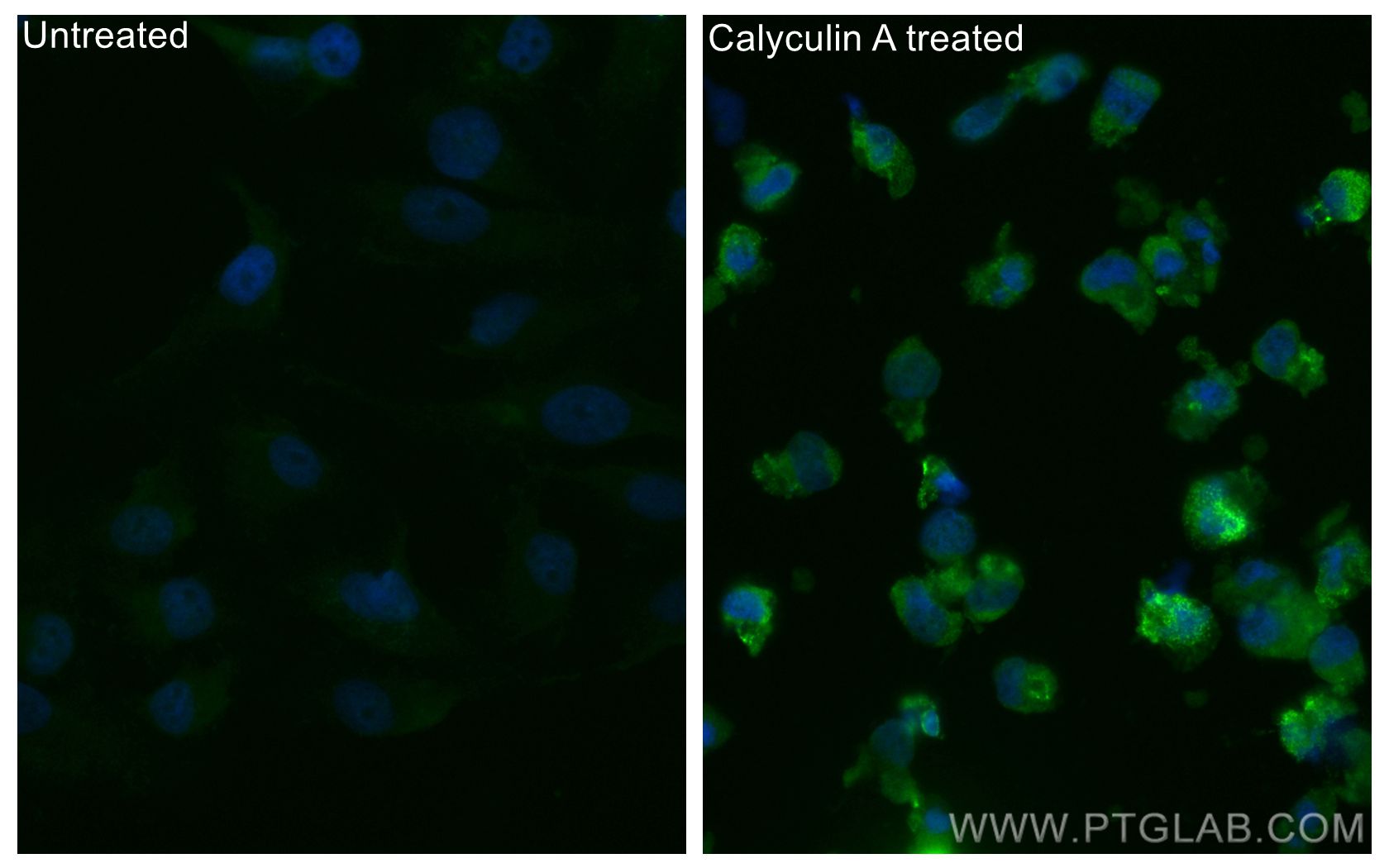 IF Staining of HeLa using CL488-80462