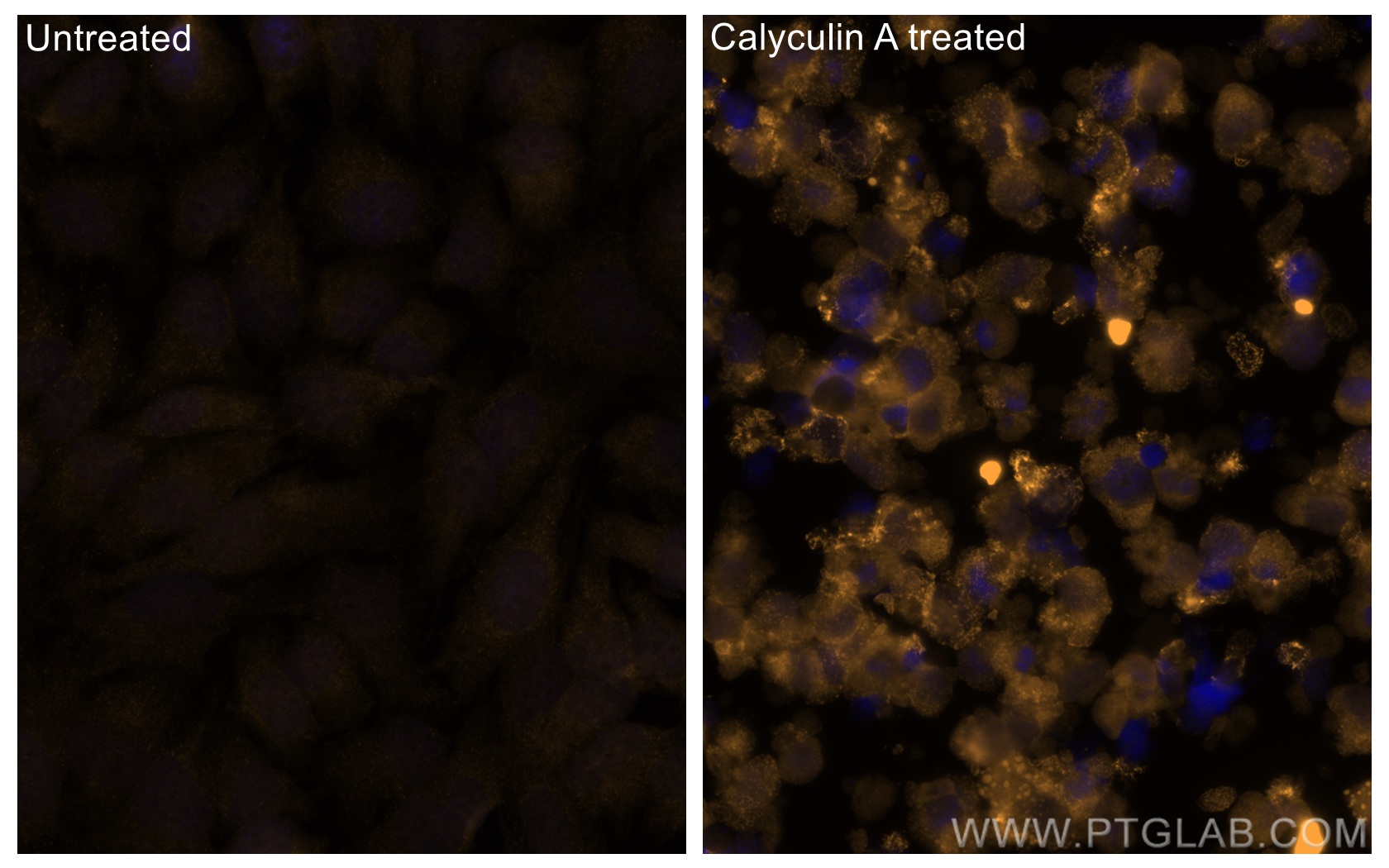 IF Staining of HeLa using CL555-80462