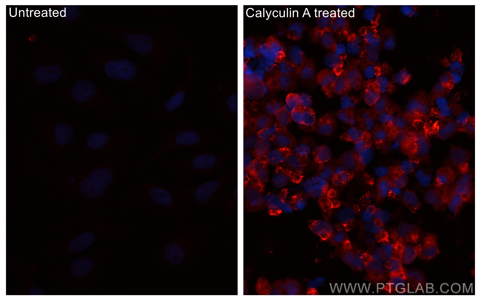 IF Staining of HeLa using CL594-80462