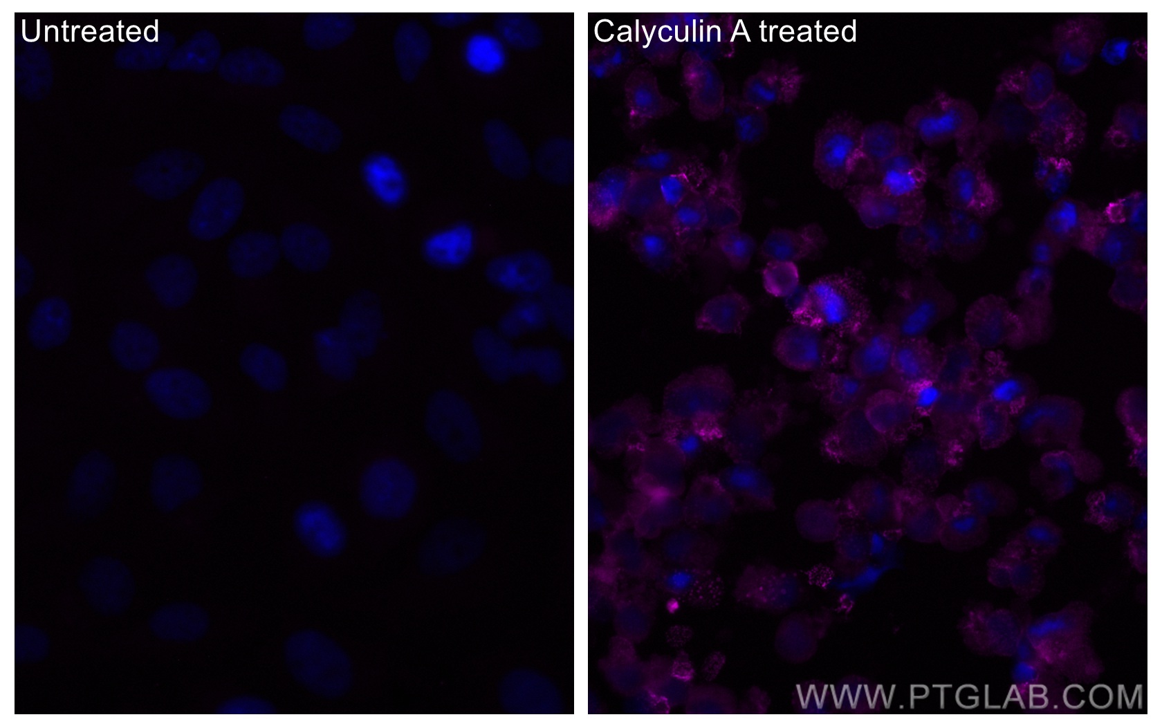 IF Staining of HeLa using CL647-80462