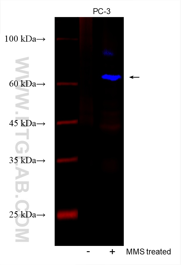 Phospho-CHEK2 (Thr68)