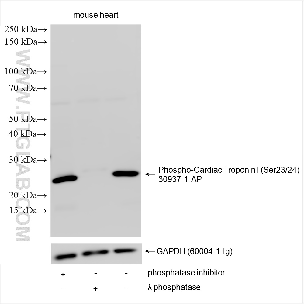 WB analysis of mouse heart using 30937-1-AP