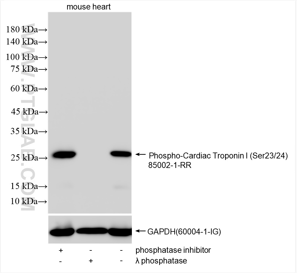 Phospho-Cardiac Troponin I (Ser23/24)