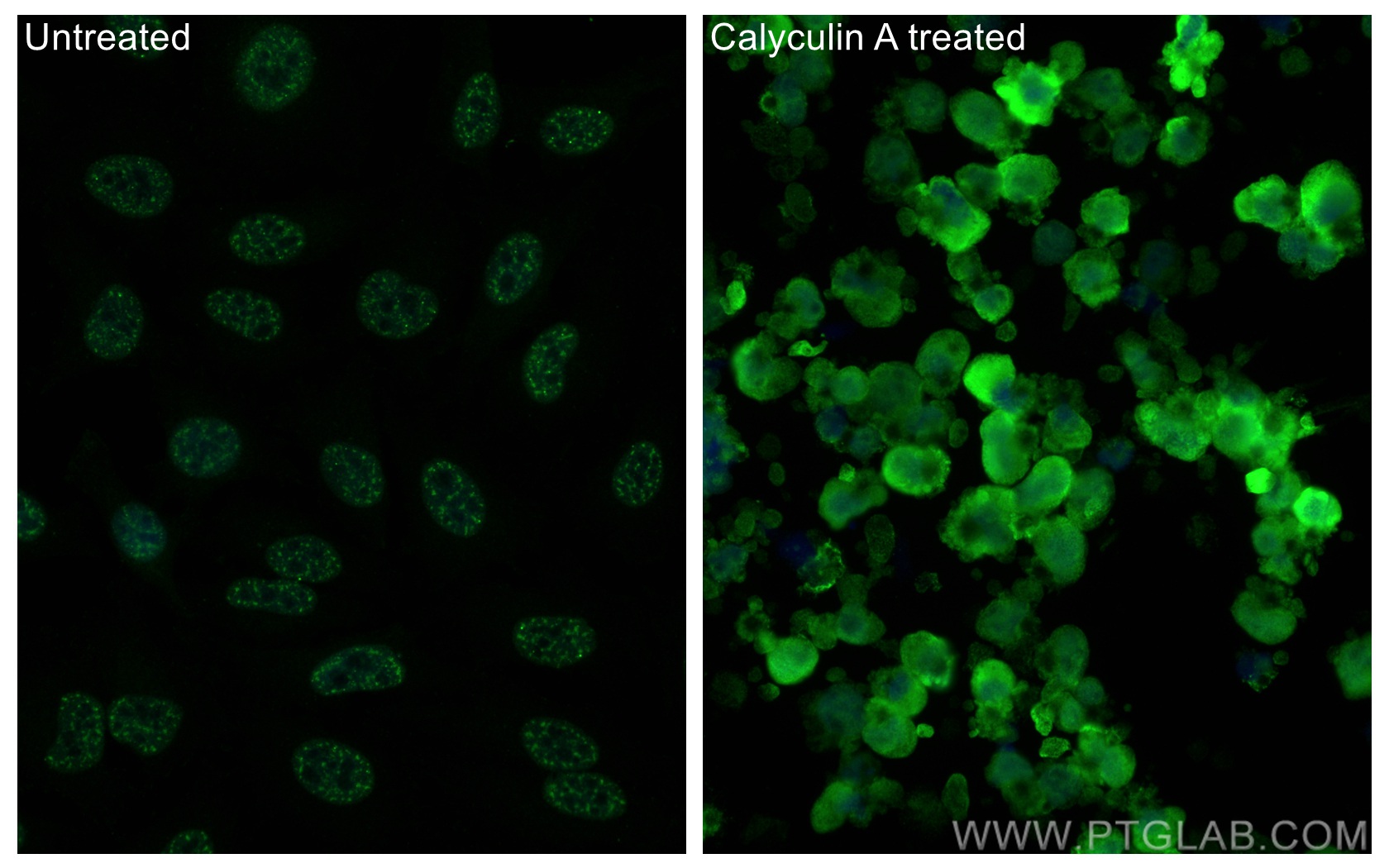 IF Staining of HeLa using 80346-1-RR (same clone as 80346-1-PBS)