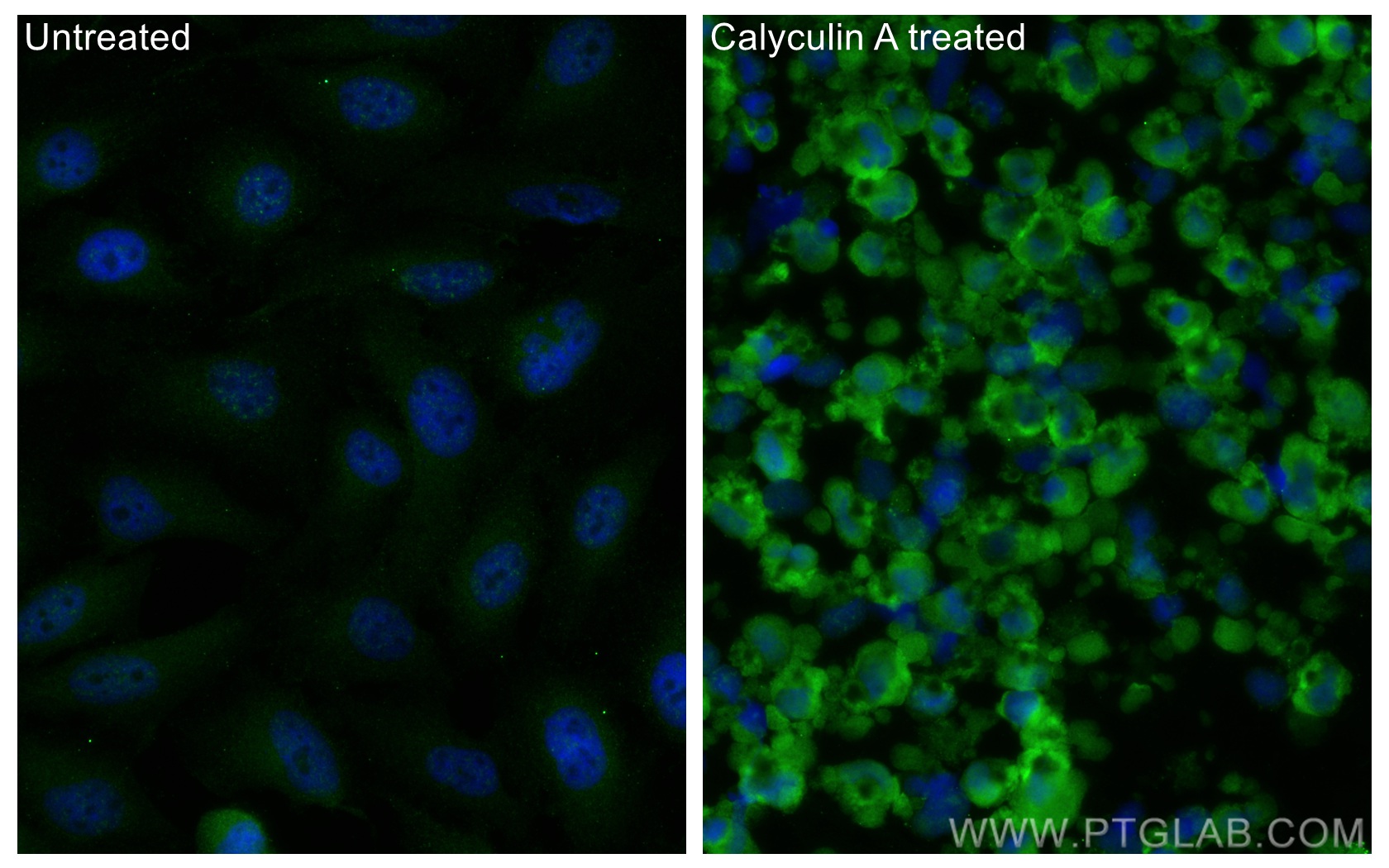 IF Staining of HeLa using 68023-1-Ig