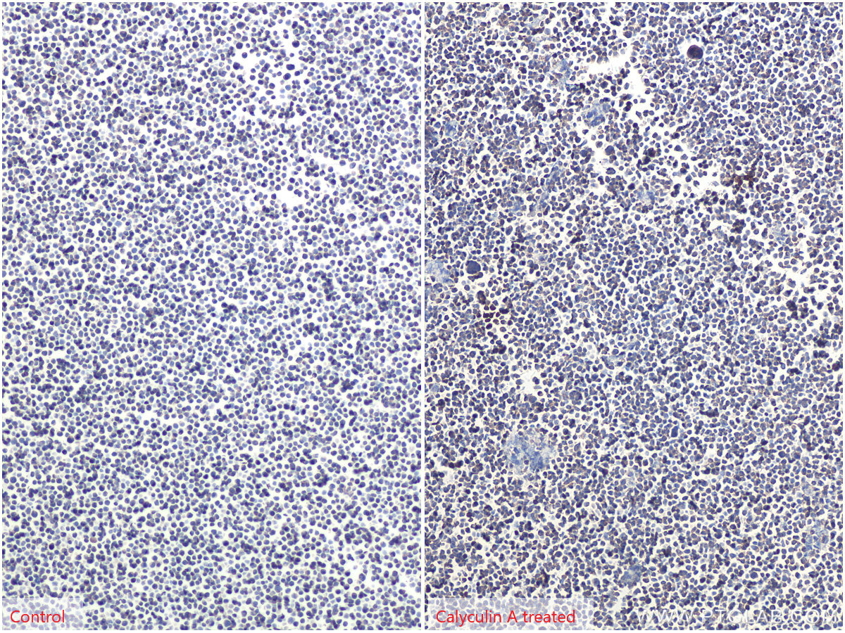 IHC staining of Jurkat using 80059-1-RR