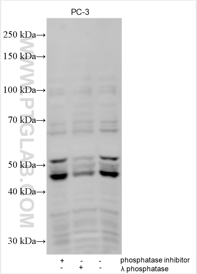 Phospho-GSK3B (Tyr216)