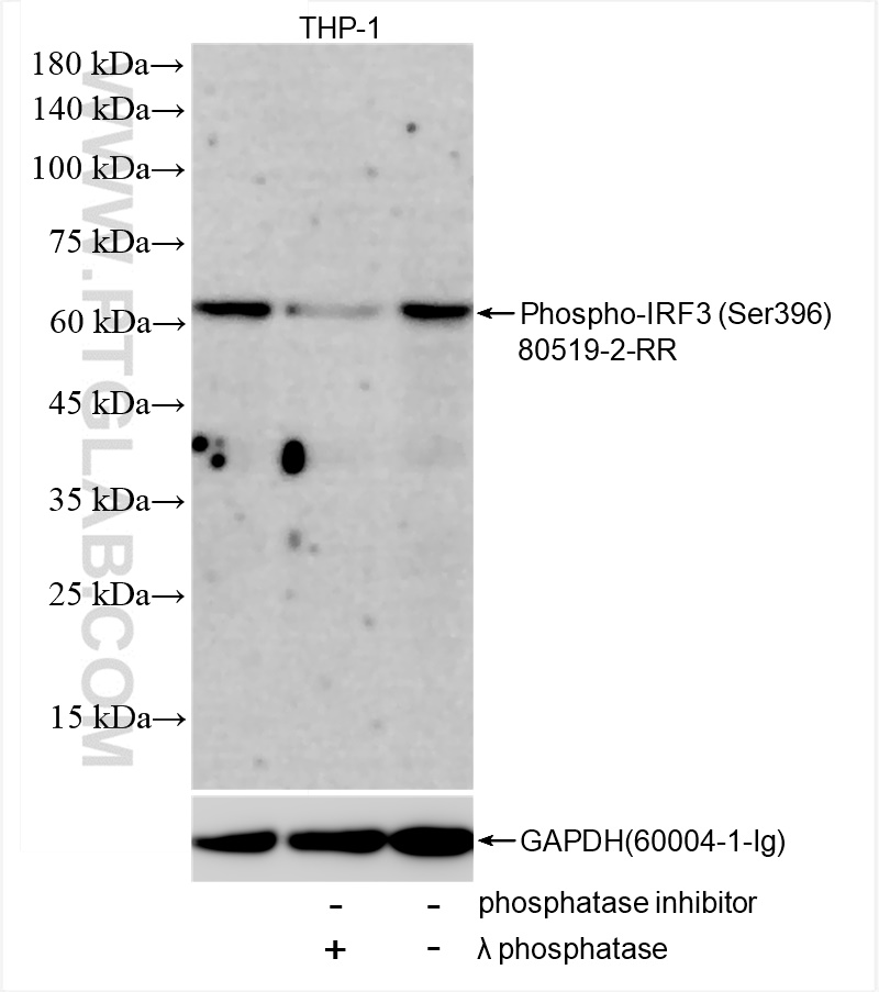 Phospho-IRF3 (Ser396)