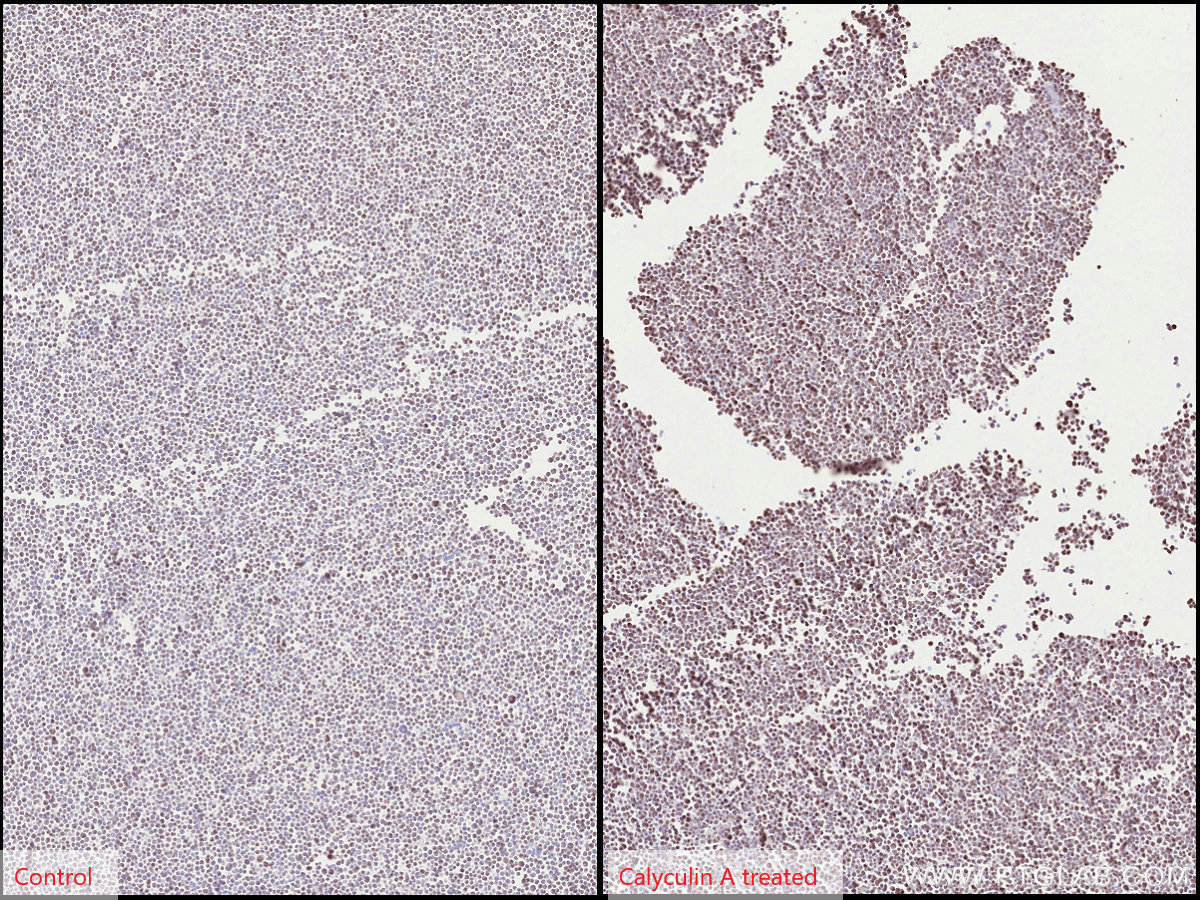 IHC staining of Jurkat using 60666-1-Ig (same clone as 60666-1-PBS)