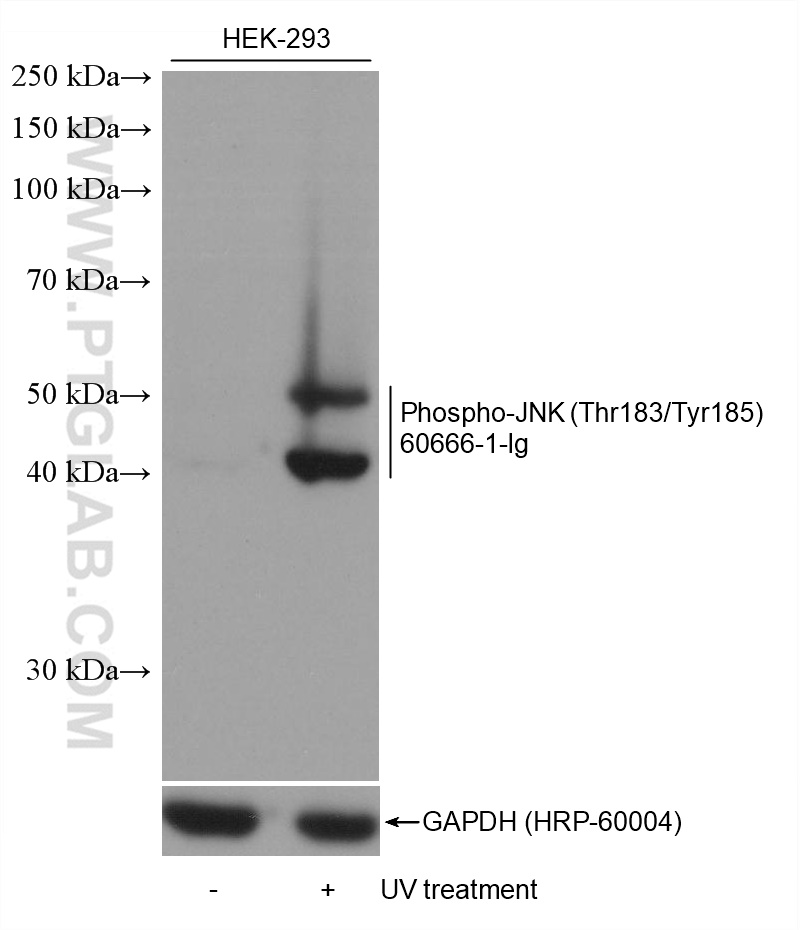 Phospho-JNK (Thr183/Tyr185)