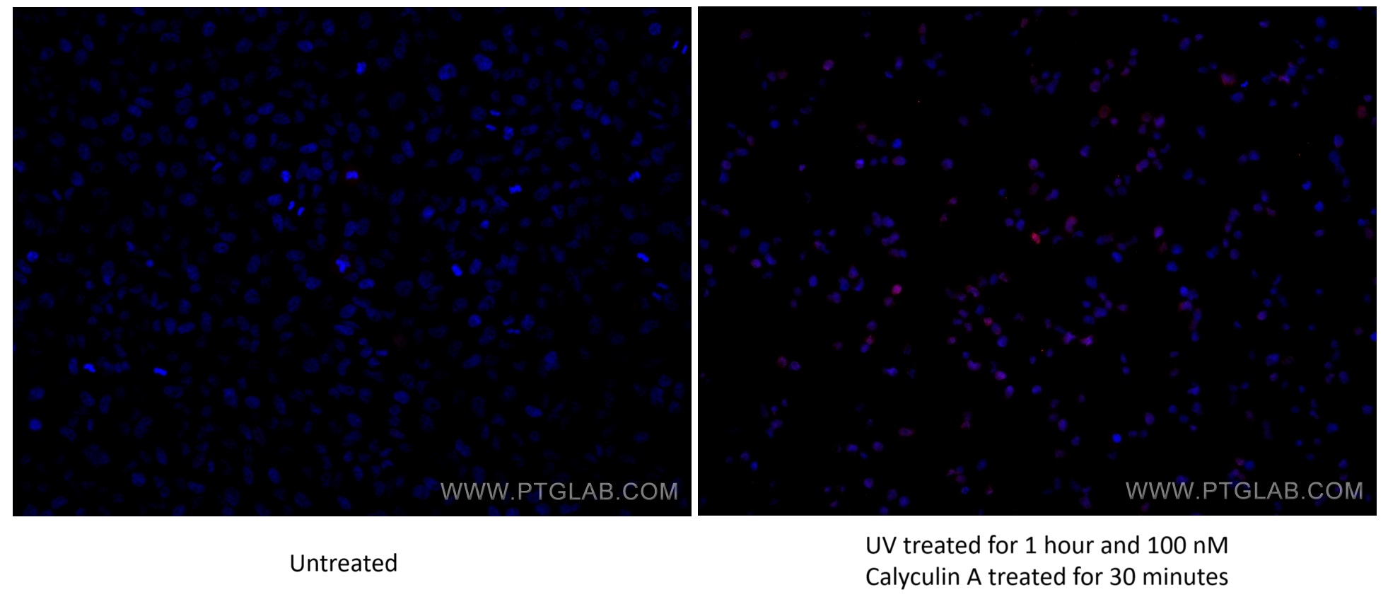 IF Staining of HeLa using 80086-1-RR (same clone as 80086-1-PBS)