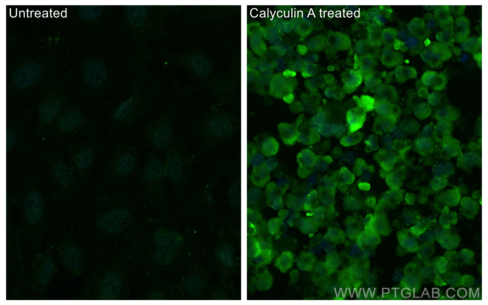 IF Staining of HeLa using 68015-1-Ig (same clone as 68015-1-PBS)