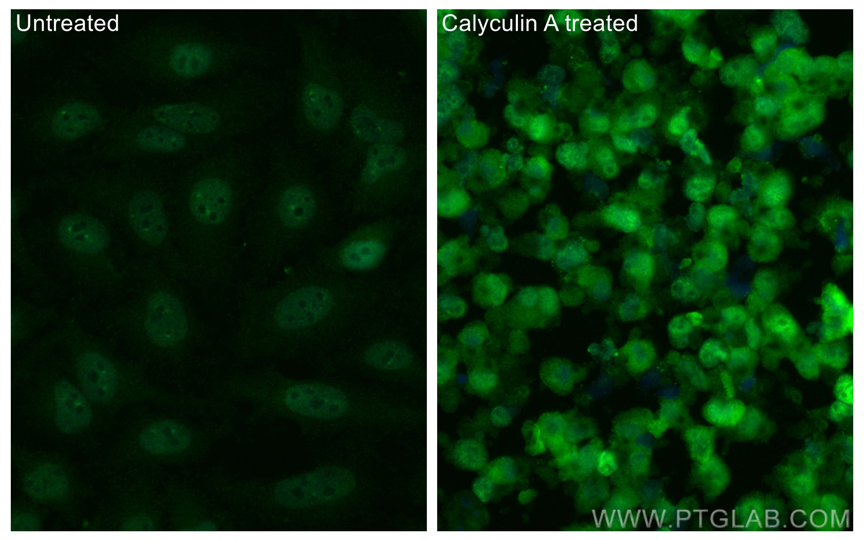 IF Staining of HeLa using CL488-68015