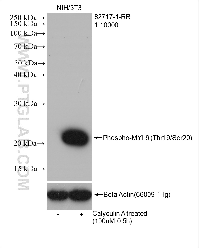 Phospho-MYL9 (Thr19/Ser20) 